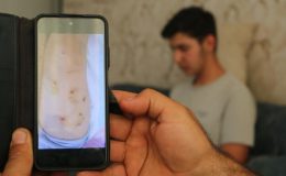 Diyarbakır’da 8 köpeğin saldırısına uğradı, dehşeti anlattı