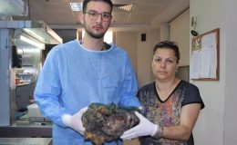 İzmir’de karın ağrısı ile hastaneye gitti, 10 kiloluk dev tümör çıkartıldı